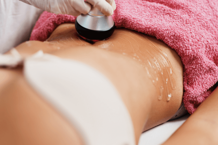 Cavitatie met maderotherapie in Almere